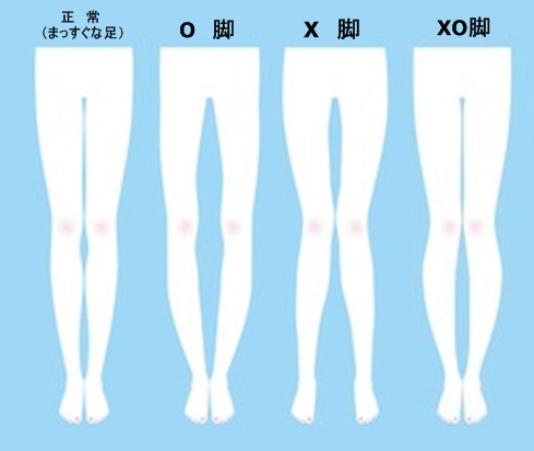 O脚X脚XO脚画像